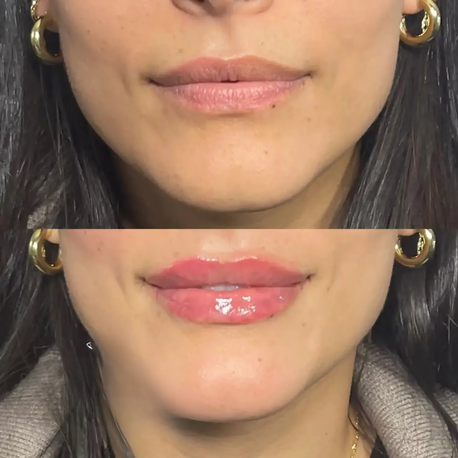Volume Lashes Before and After fourteen Refresh Aesthetics