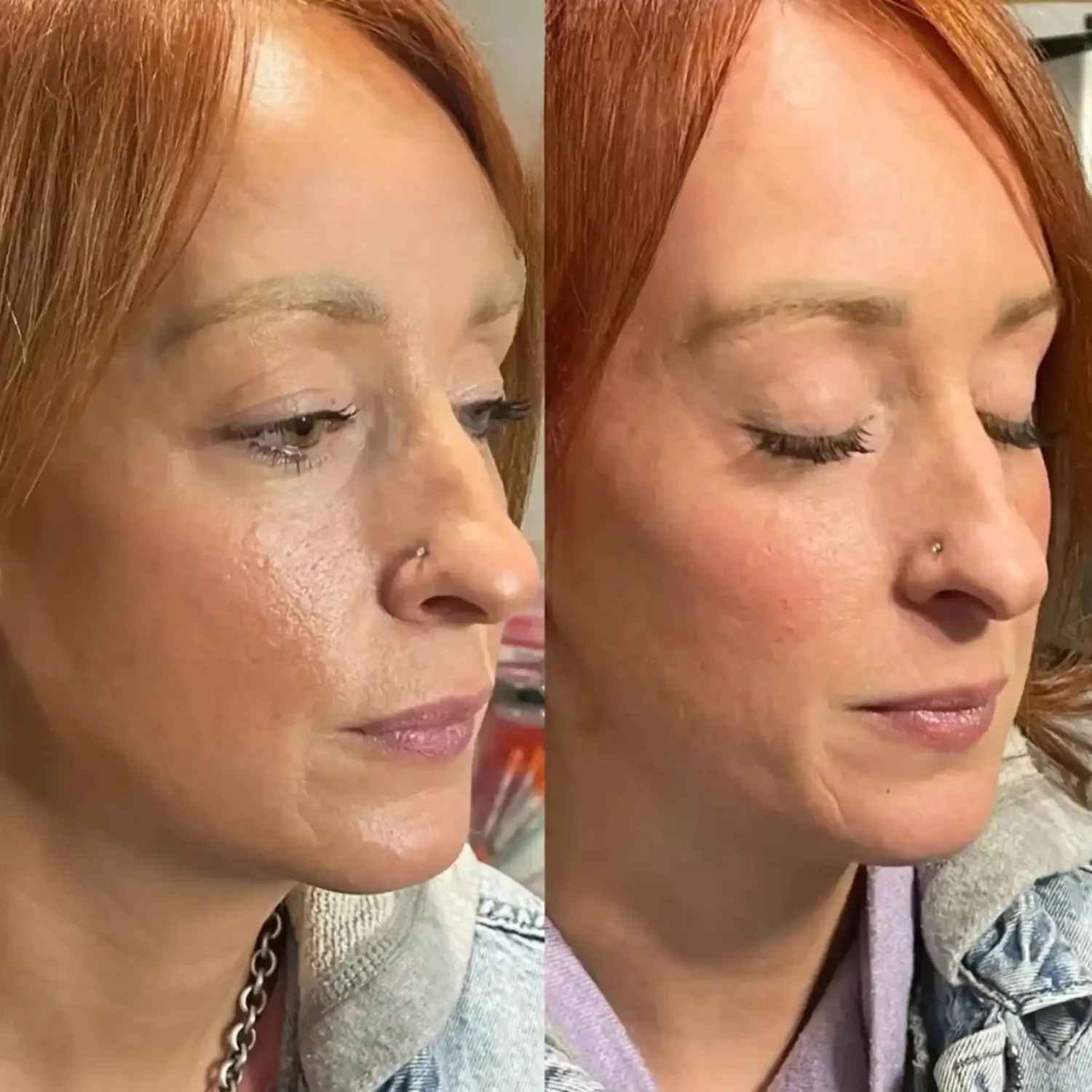 Volume Lashes Before and After twelve Refresh Aesthetics